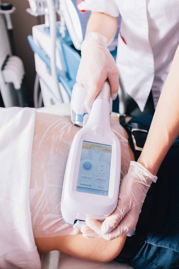 Cryolipolyse à Montpellier : comment cela fonctionne ?